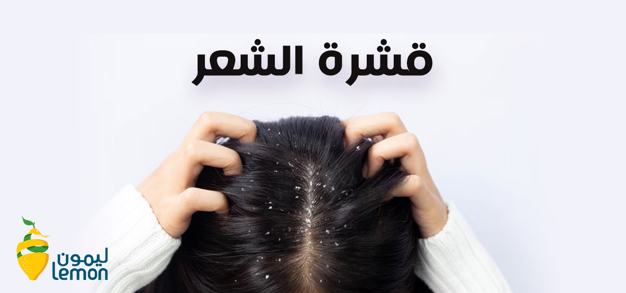 أفضل علاج لقشرة الشعر: حان وقت التخلص منها أفضل علاج لقشرة الشعر: حان وقت التخلص منها