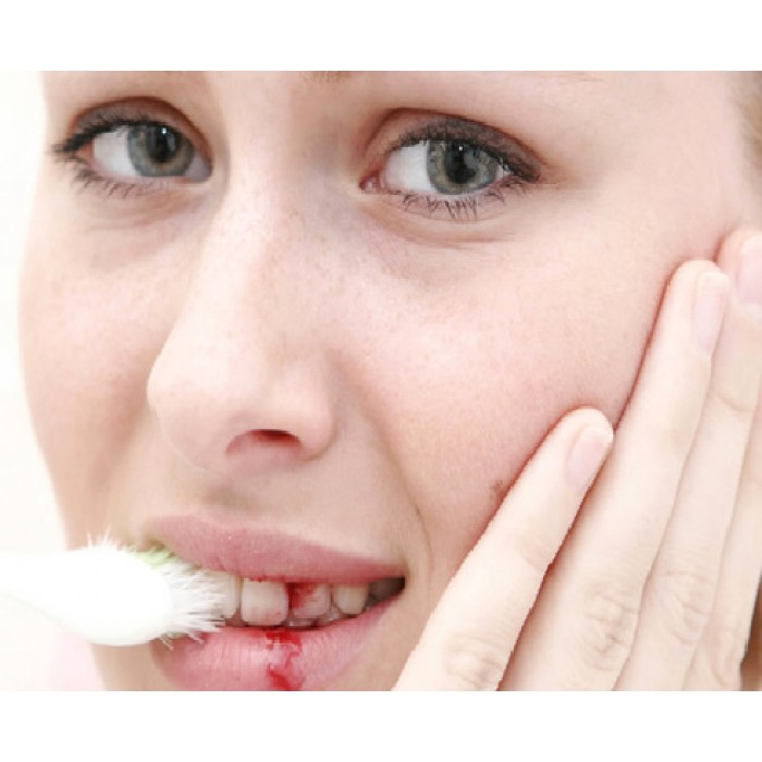 معجون اسنان لاكالوت اكتيف افضل معجون اسنان من لاكالوت يساعد على علاج التهاب اللثة